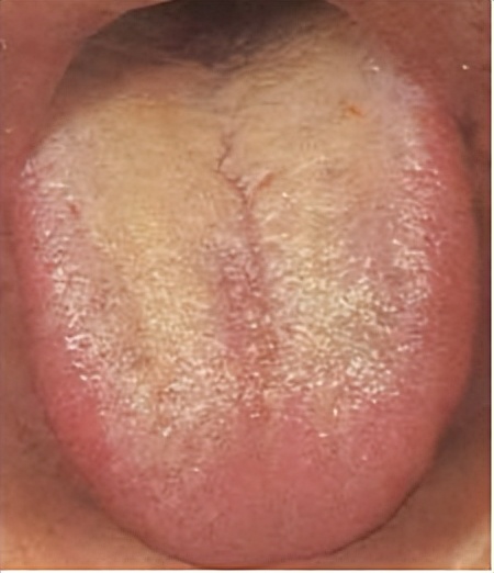 出汗多了该怎么调理,身体这4处常出汗要警惕