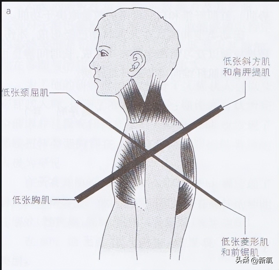脸太下垂,脸下垂了是不是就显胖