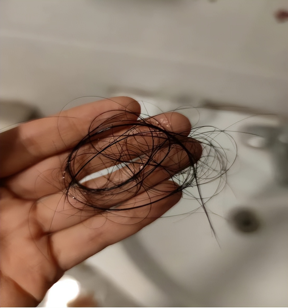 怎样治疗脱发掉头发最有效,掉头发怎么办教你一招永不脱发