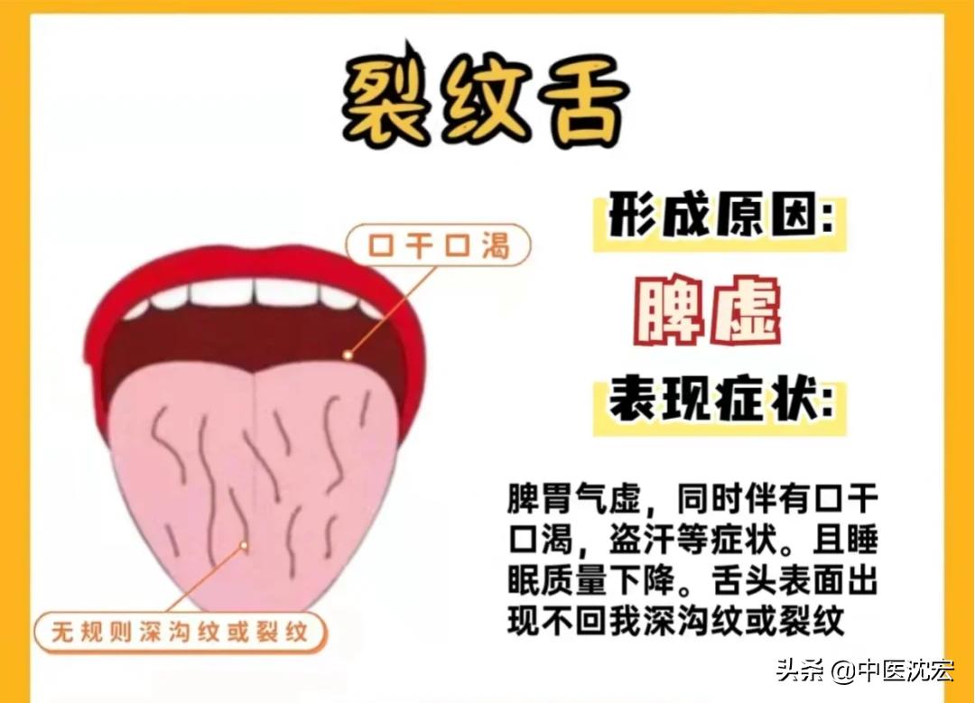 中医教你看舌头得知身体表现,中医看舌头舌苔图谱