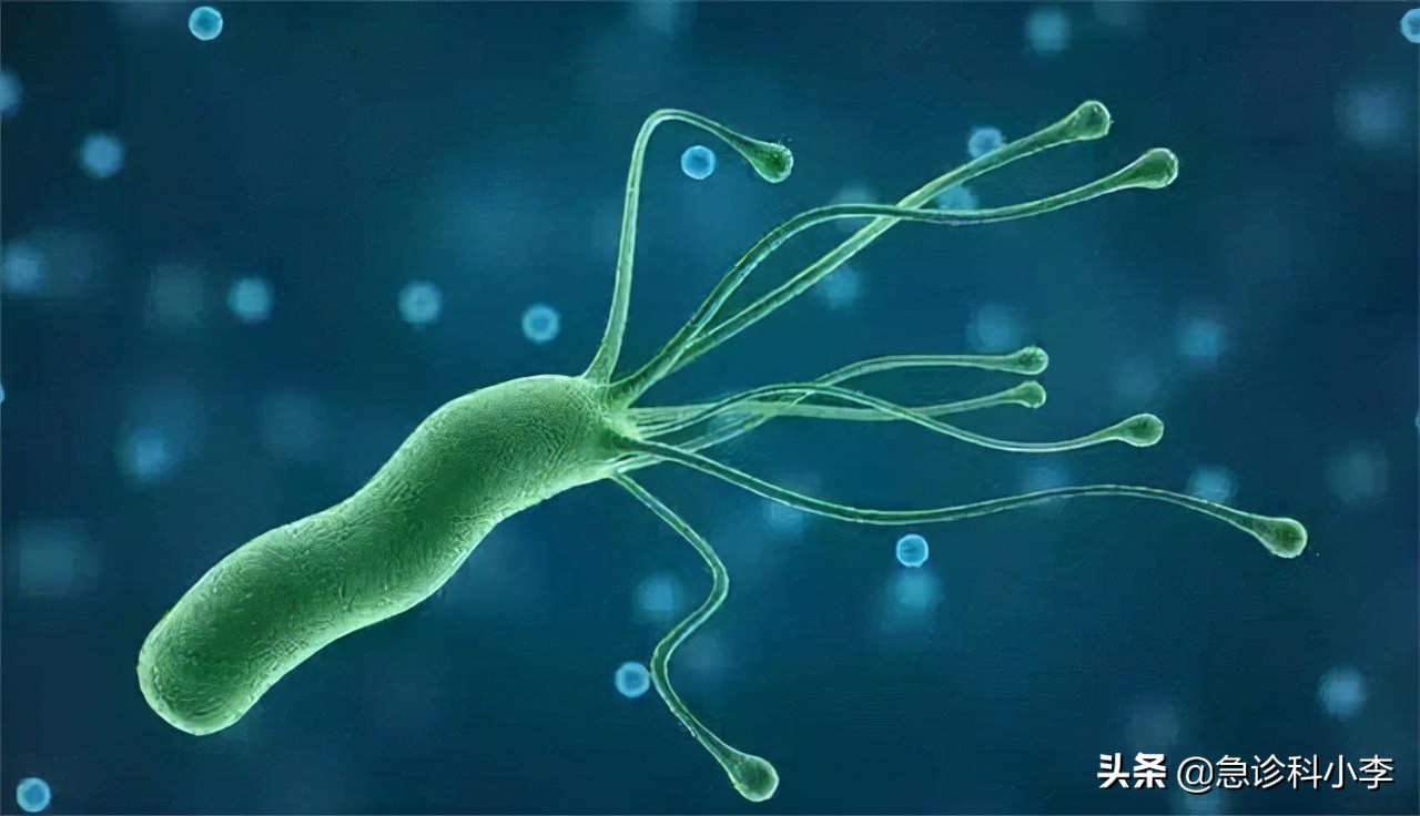 幽门螺杆菌导致的胃癌如何治疗,幽门螺杆菌根除了还会得胃癌吗