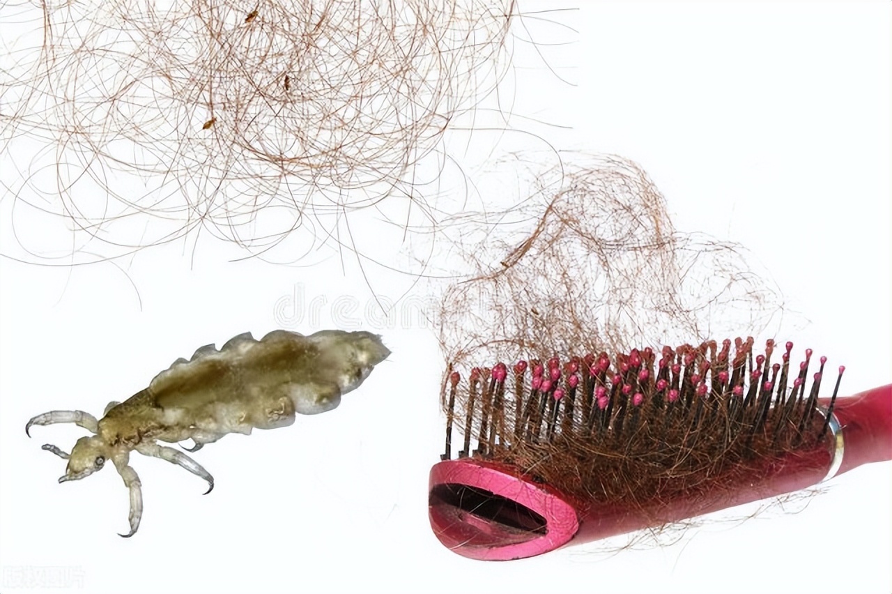 阴虱传播途径有3个，很多人都中招了！做好2点预防，希望你知道