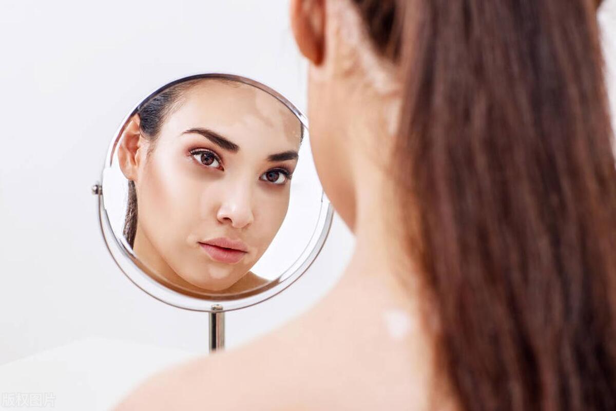 白癜风为什么难治,白癜风为什么难治疗呢