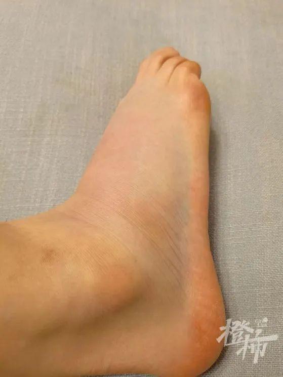 刘畊宏毽子操早练好还是晚上练好,刘畊宏毽子操要跳多少遍才有用