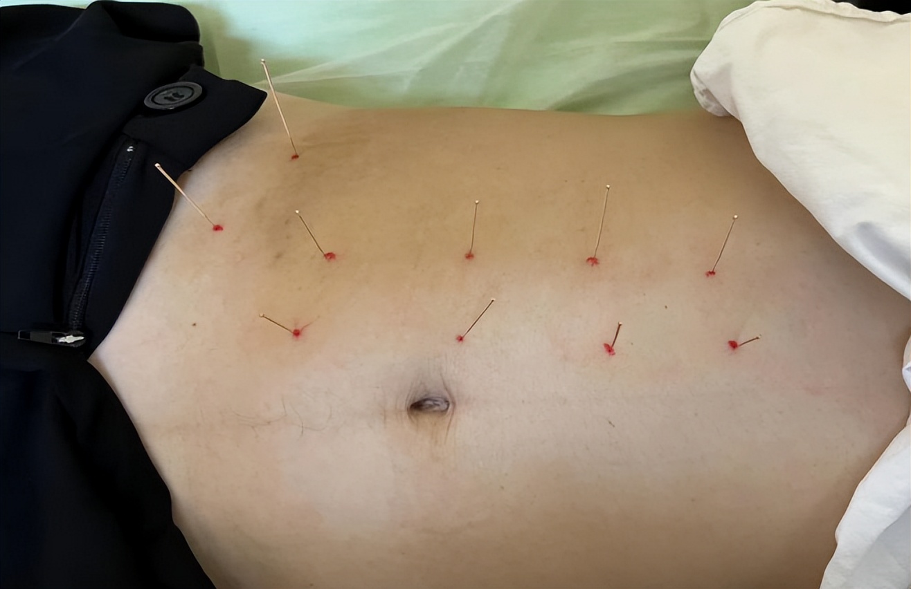 左腰腹部疼痛警惕四种病,左侧腰腹部隐痛要警惕三种病