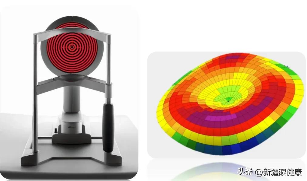 NBA球迷看过来：詹皇同款摘镜术式