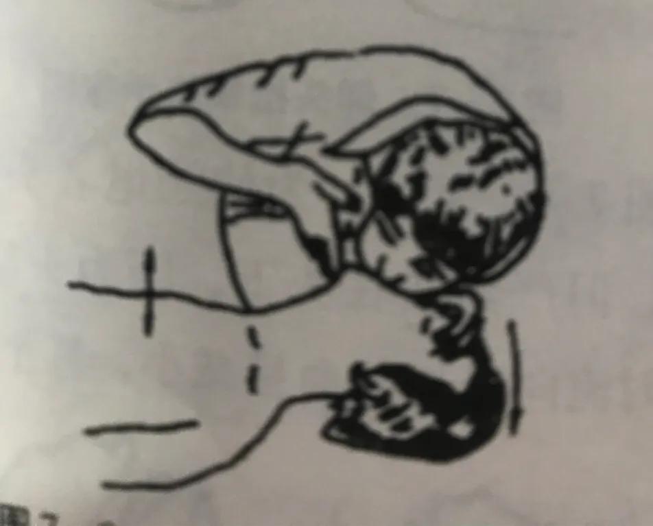 发现有人触电怎么办,经常静电触电怎么办