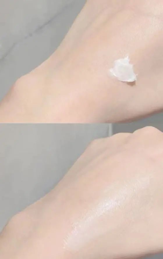 黑绷带是最好的护肤品吗,黑钥匙面霜和黑绷带哪个适合痘痘