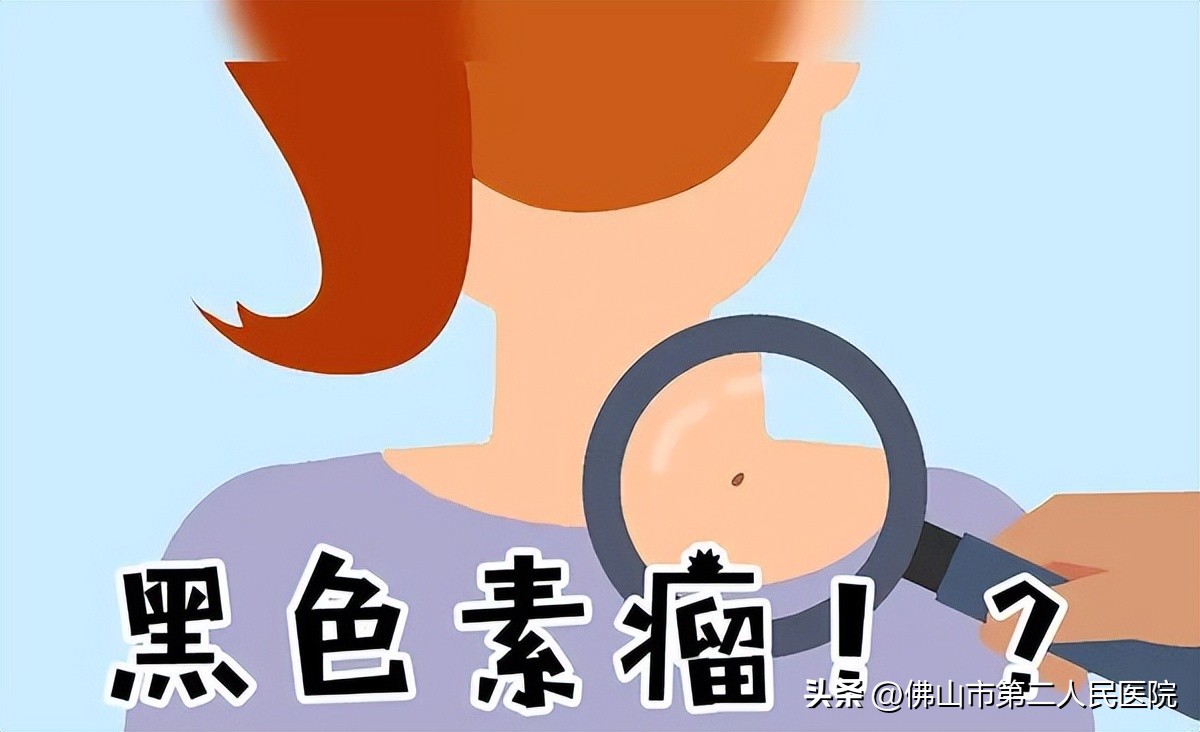 年轻歌手得黑色素瘤去世,歌手黑痣和黑色素瘤的区别