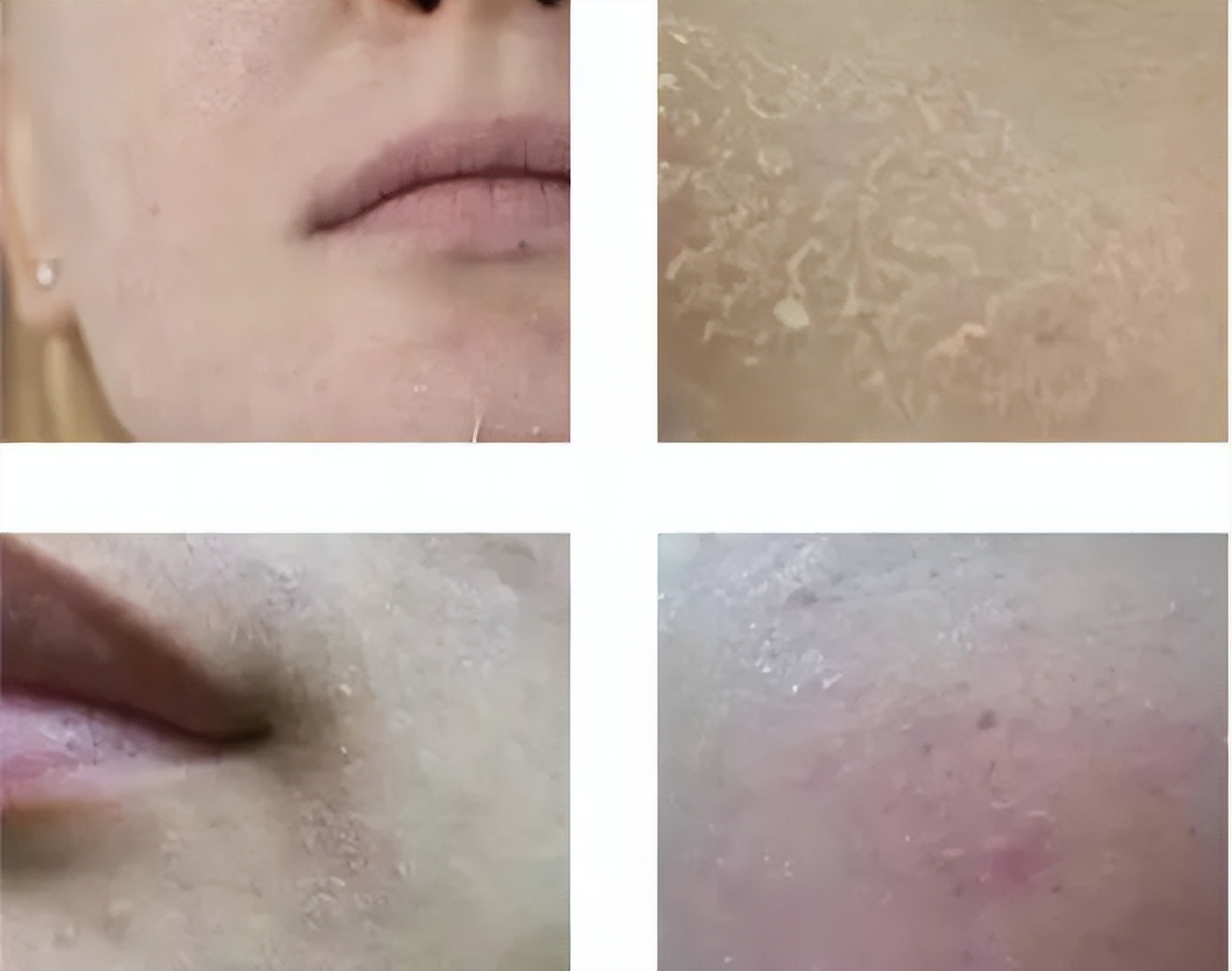 秋冬季节嘴唇干燥起皮怎么办,秋冬身体干燥起皮怎么治