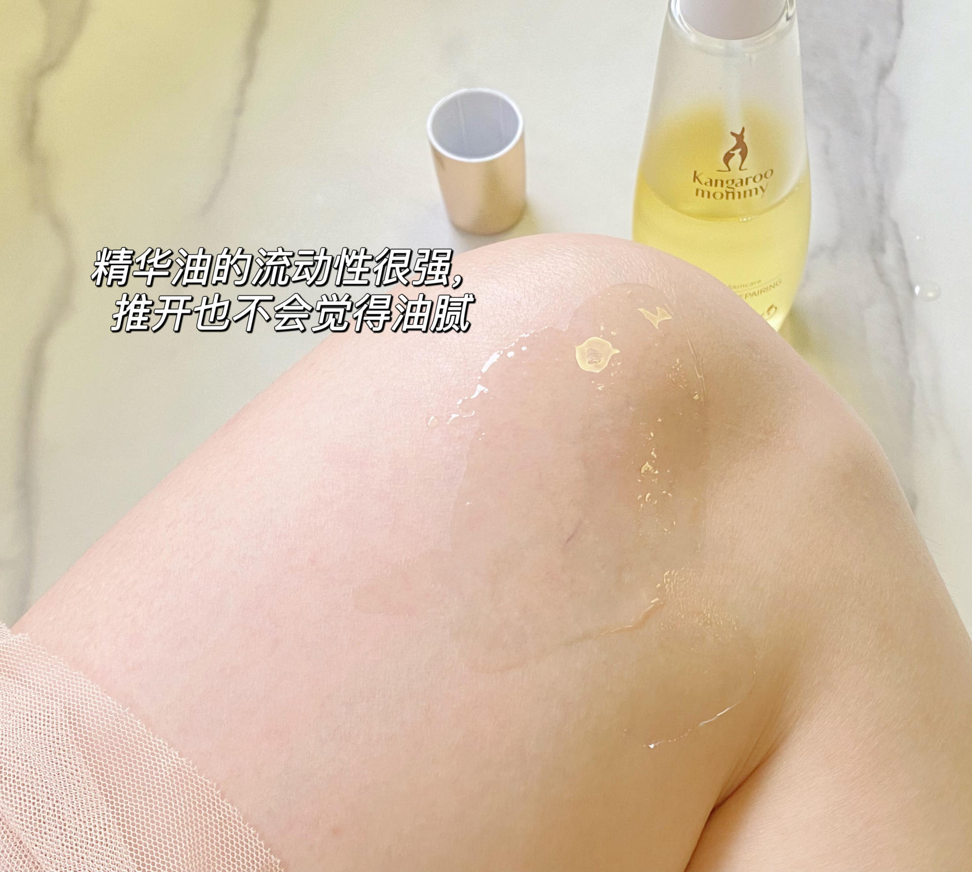 红色肥胖纹和白色肥胖纹淡化,肥胖纹能彻底消除吗