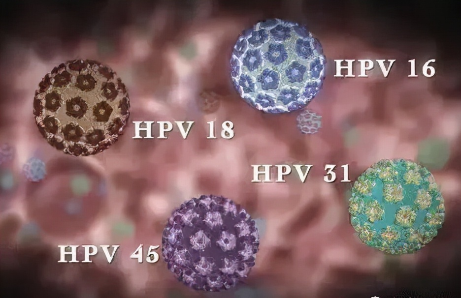 hpv和疣是一种病吗,hpv病毒疣是什么样的