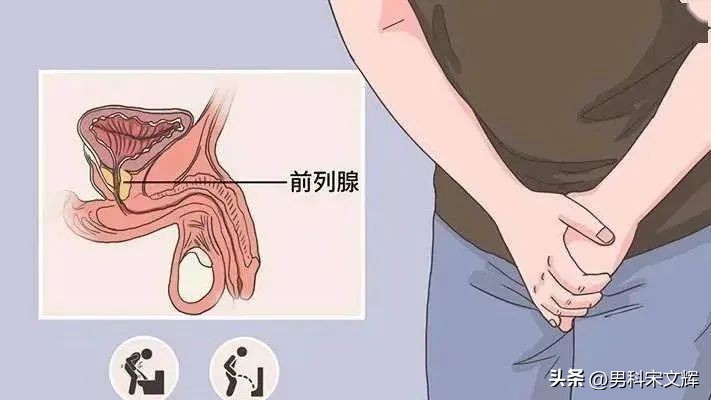 天津看男科前列腺哪家比较好,天津看前列腺哪家医院好一些