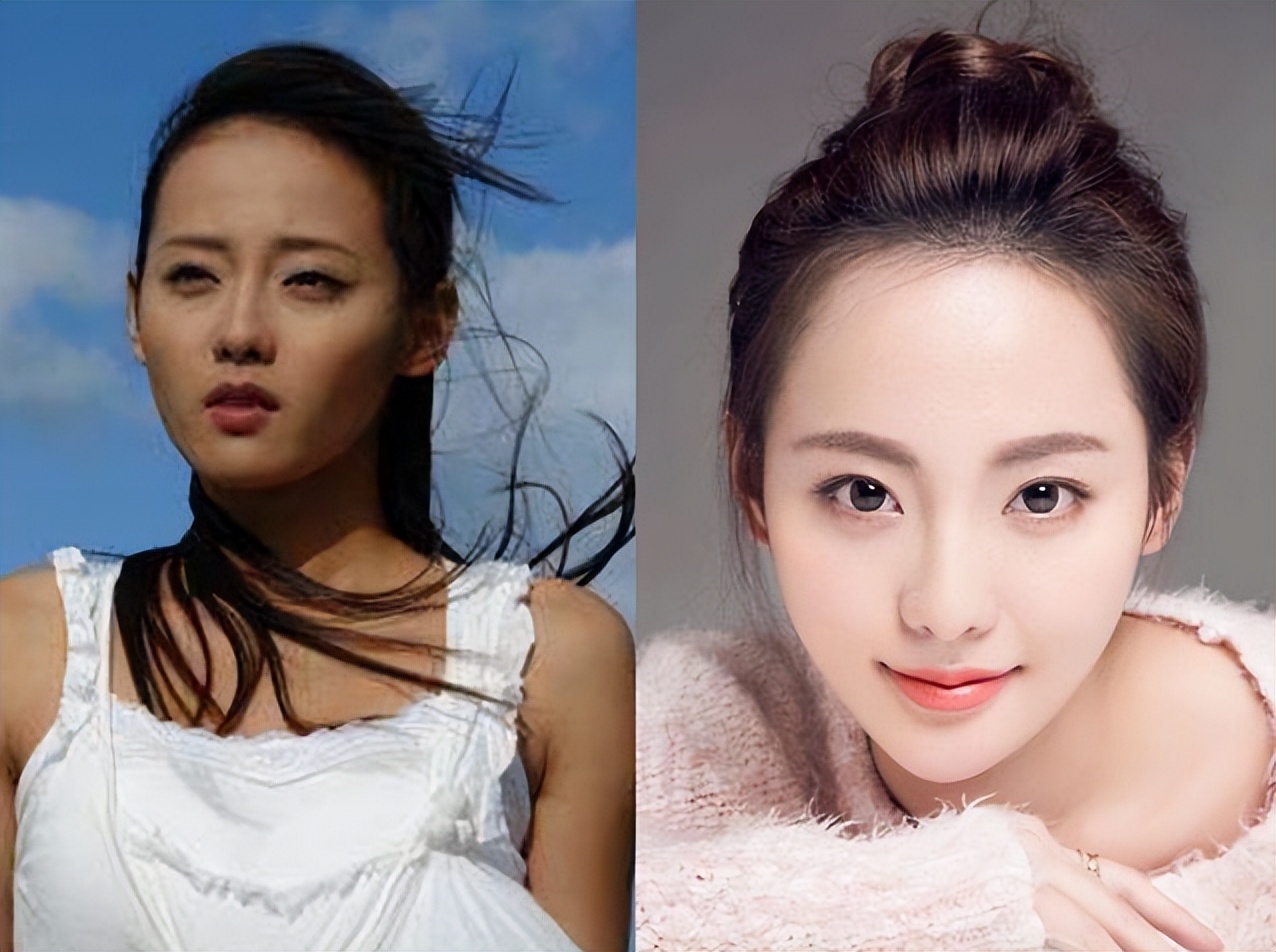 泰国美白针真实事件,女子连续打6年美白针