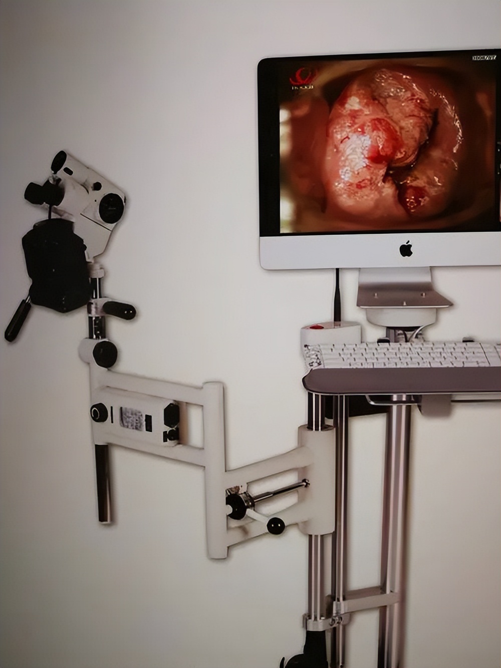 妇科激素检查是查什么,妇科检查hpv是查些什么