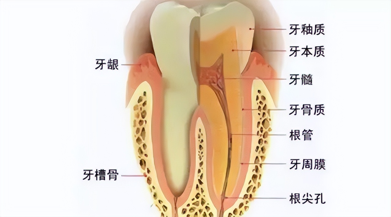 牙齿断了一半怎么处理最好多少钱,牙齿断了一半怕冰怎么处理最好
