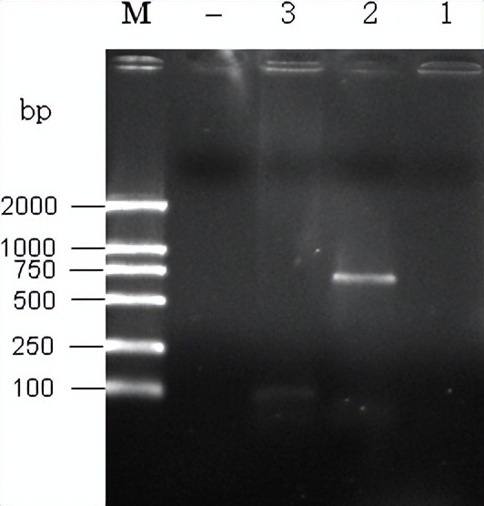 猪源链球菌的分离鉴定