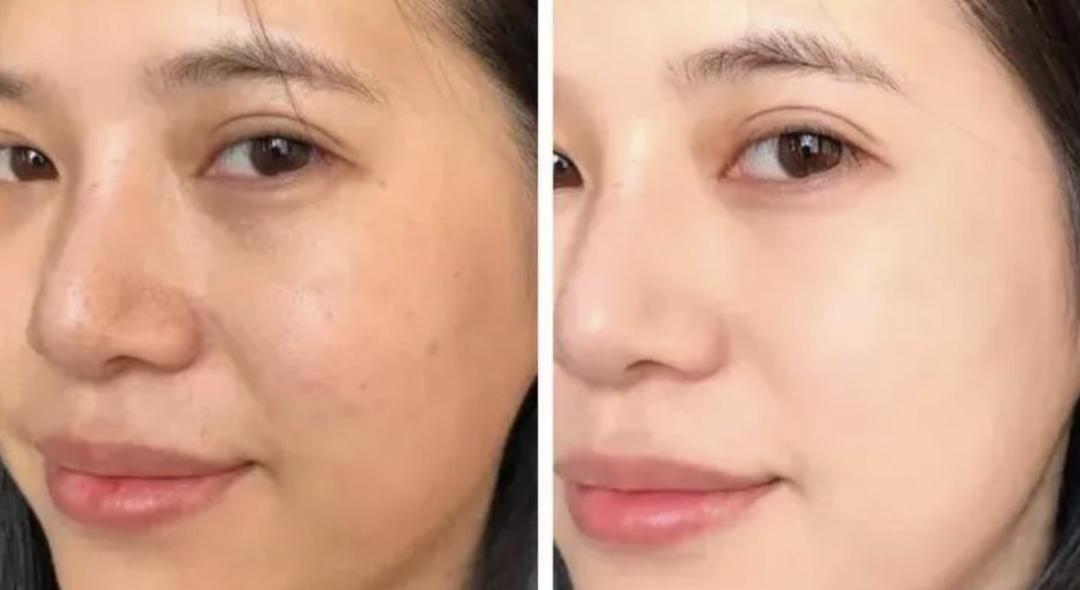 欧莱雅复颜抗皱水乳套装短视频,欧莱雅抗皱紧致水乳套装女