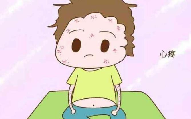 医学科普湿疹做好这几点减少复发,谈谈湿疹的中医药防治与调养