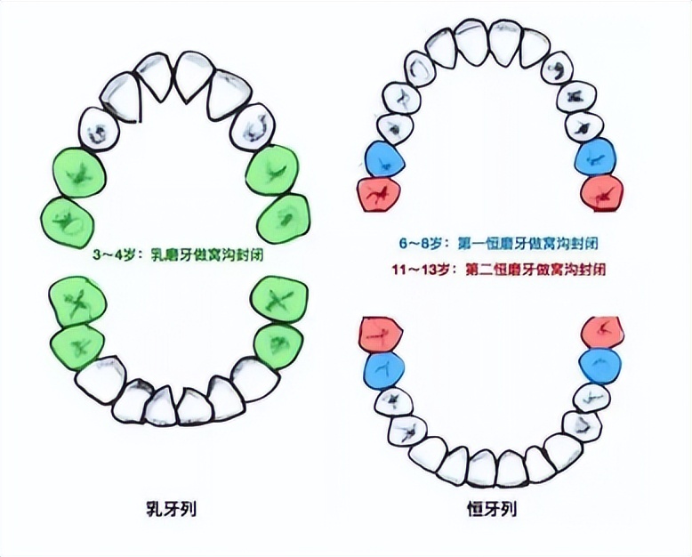 测评飞利浦电动儿童牙刷,儿童电动牙刷推荐5-12岁飞利浦