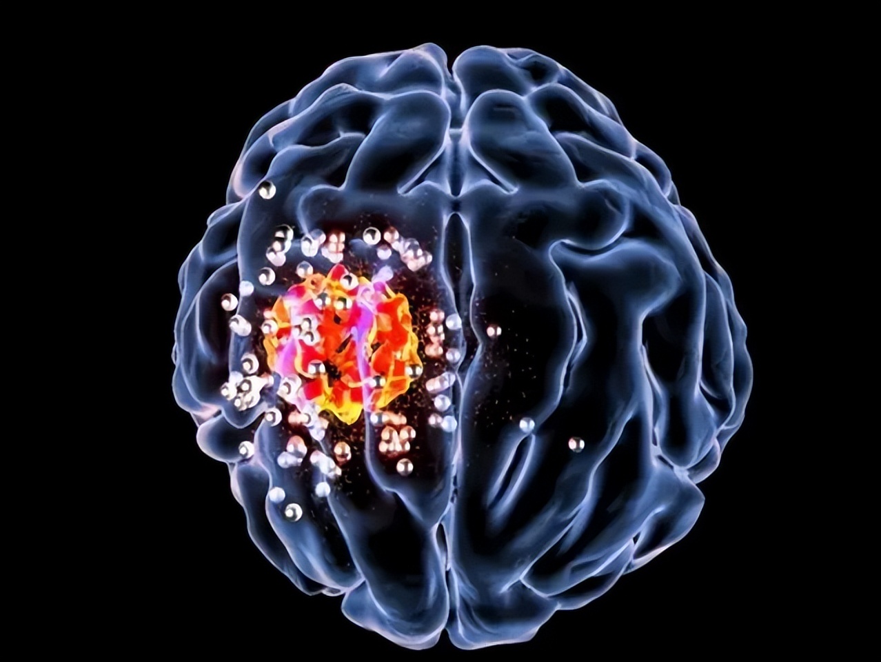 脑瘤能治好吗最明显的4个征兆,脑瘤要怎么治疗比较好