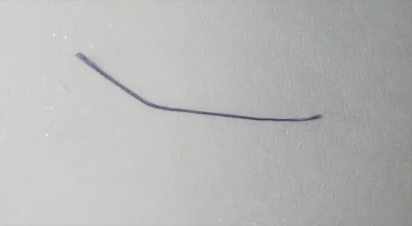 女孩痔疮手术恢复过程,女生痔疮手术的全部流程