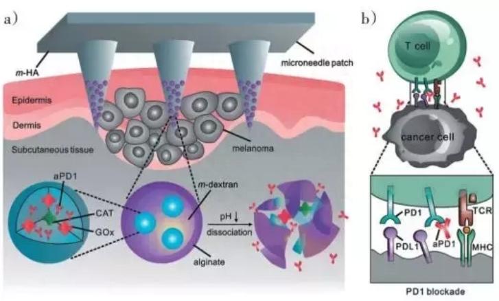 纳米技术在癌症诊断中的应用论文,宫颈癌靶向治疗的研究进展