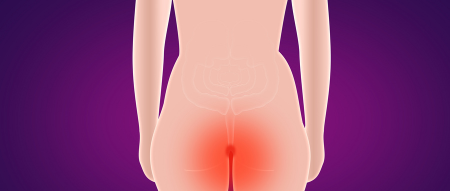 屁股上有轻微的痔疮怎么办,屁股长痔疮应该怎么解决