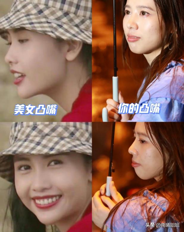 蒜头鼻却很漂亮的原因,蒜头鼻是真的影响颜值