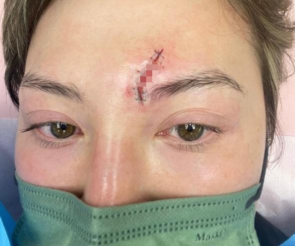 31岁知名女明星出车祸,31岁女演员车祸