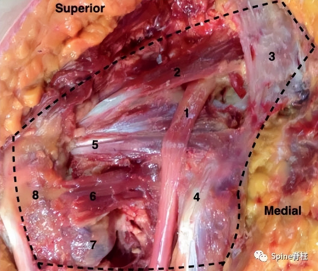 腰椎间盘突出下肢放射痛严重吗,下肢放射疼痛是间断性严重吗