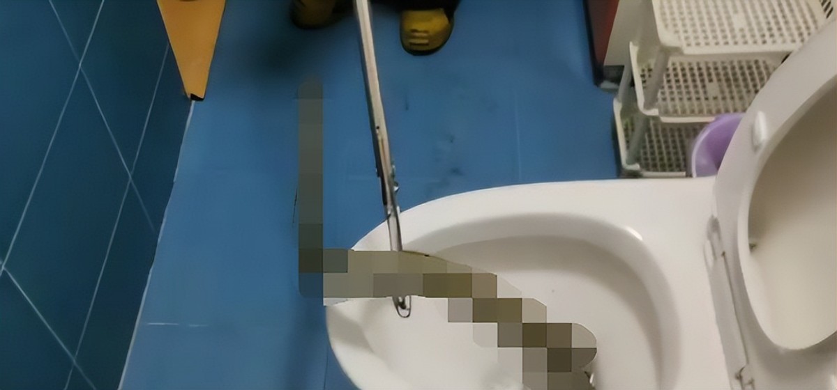 蛇从马桶里面爬出来咬伤人,女子被蛇咬到手上有蛇纹