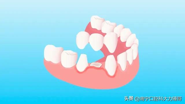 一颗牙得花多少钱,看一次牙