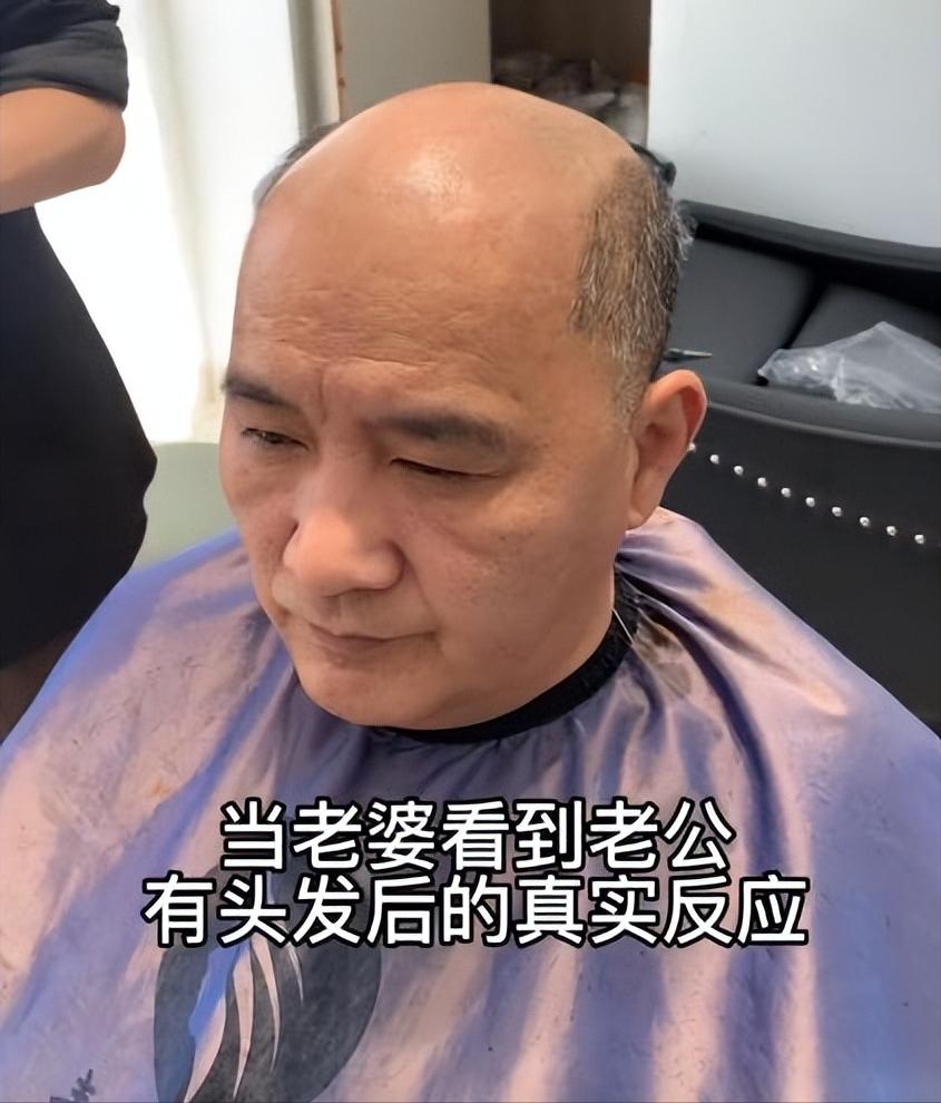 浙江宁波,老公秃顶老婆看着心烦,戴上假发又有危机感:男人真难
