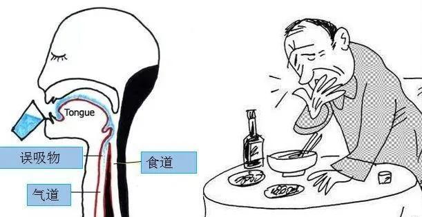 老人呛咳最佳治疗方法,老人睡觉老是呛咳是怎么回事