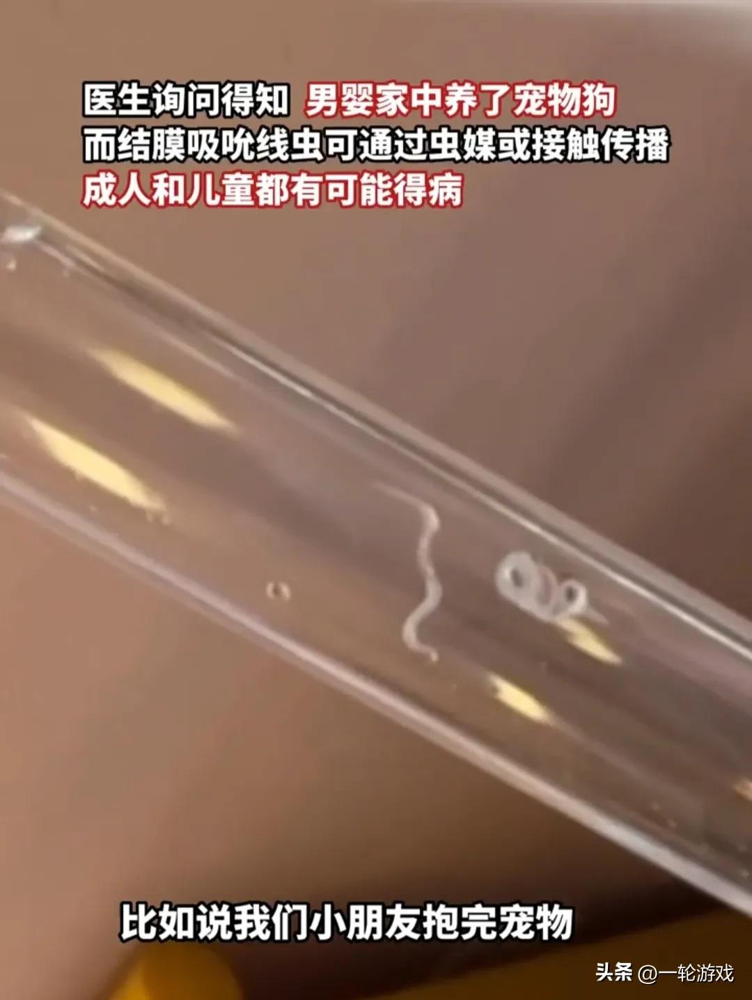 八个月大婴儿眼睛取出虫,八个月婴儿眼睛里面寄生虫后续