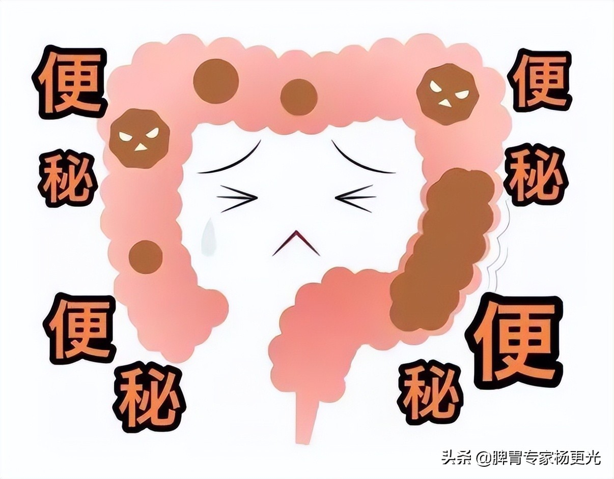 便秘被治好了,自行灌肠导致长期便秘