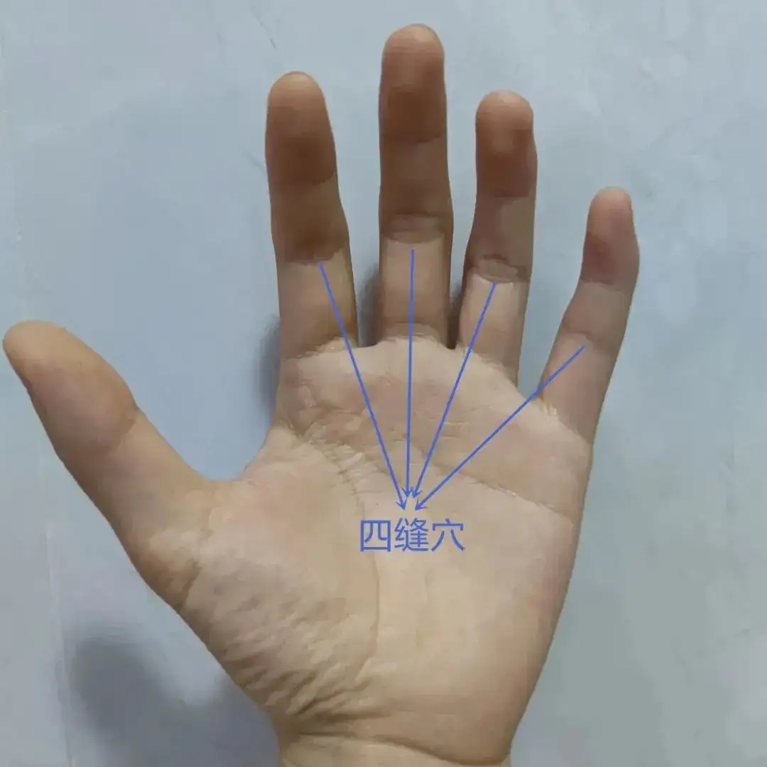 中医治小儿厌食针灸穴位,董氏针灸治疗帕金森处方