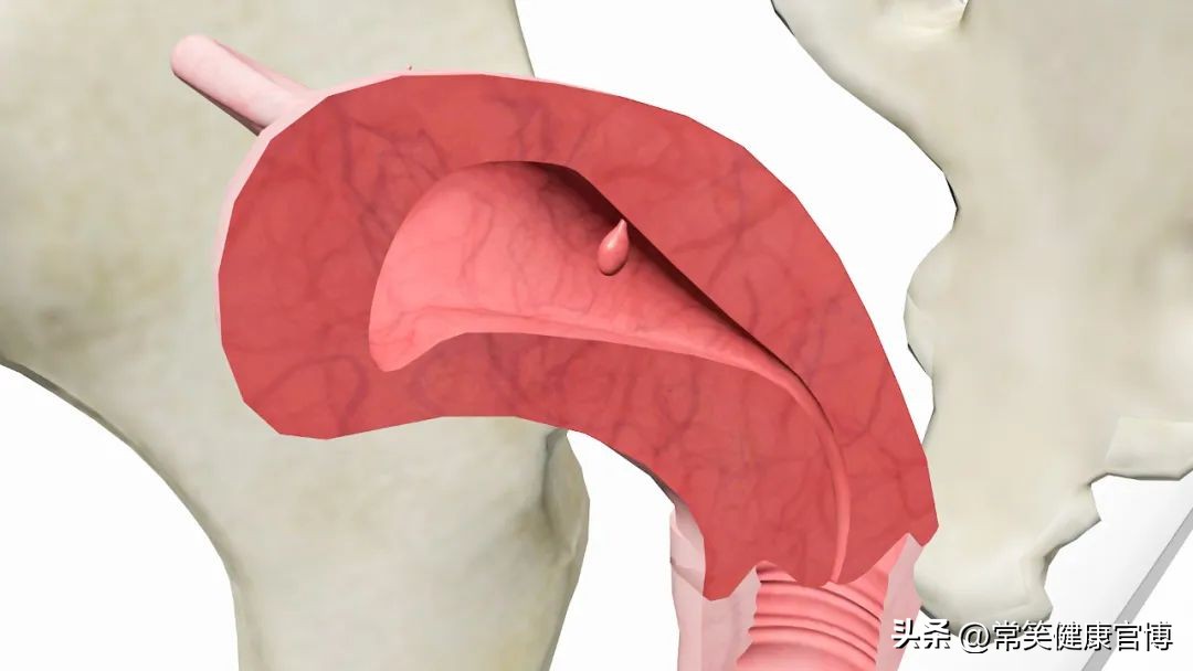 当“备孕”遇上“子宫内膜息肉”，宫腔镜检查起大作用。