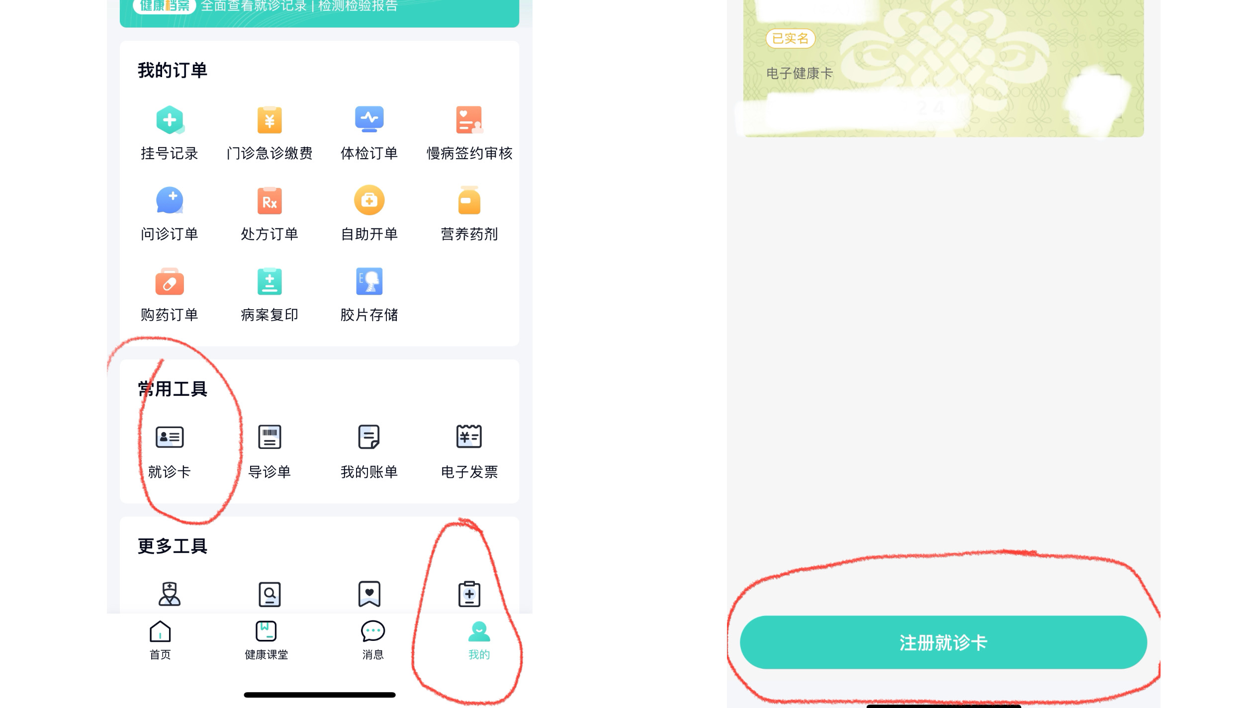 华西医院就诊必须要就诊卡吗,华西医院电子就诊卡注册不了
