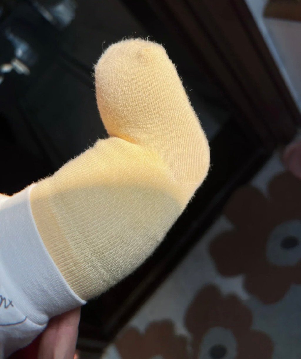 婴儿没后脚跟会怎样,啥意思原来婴儿是没有后脚跟的