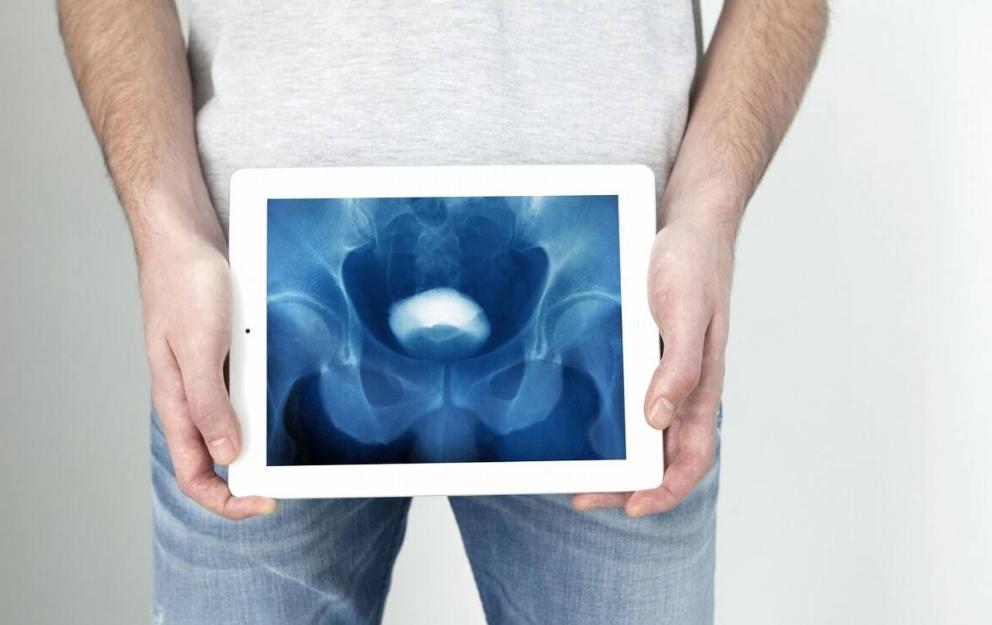 50岁男人需要补充雄激素吗,男人到中年需要补充雄激素吗