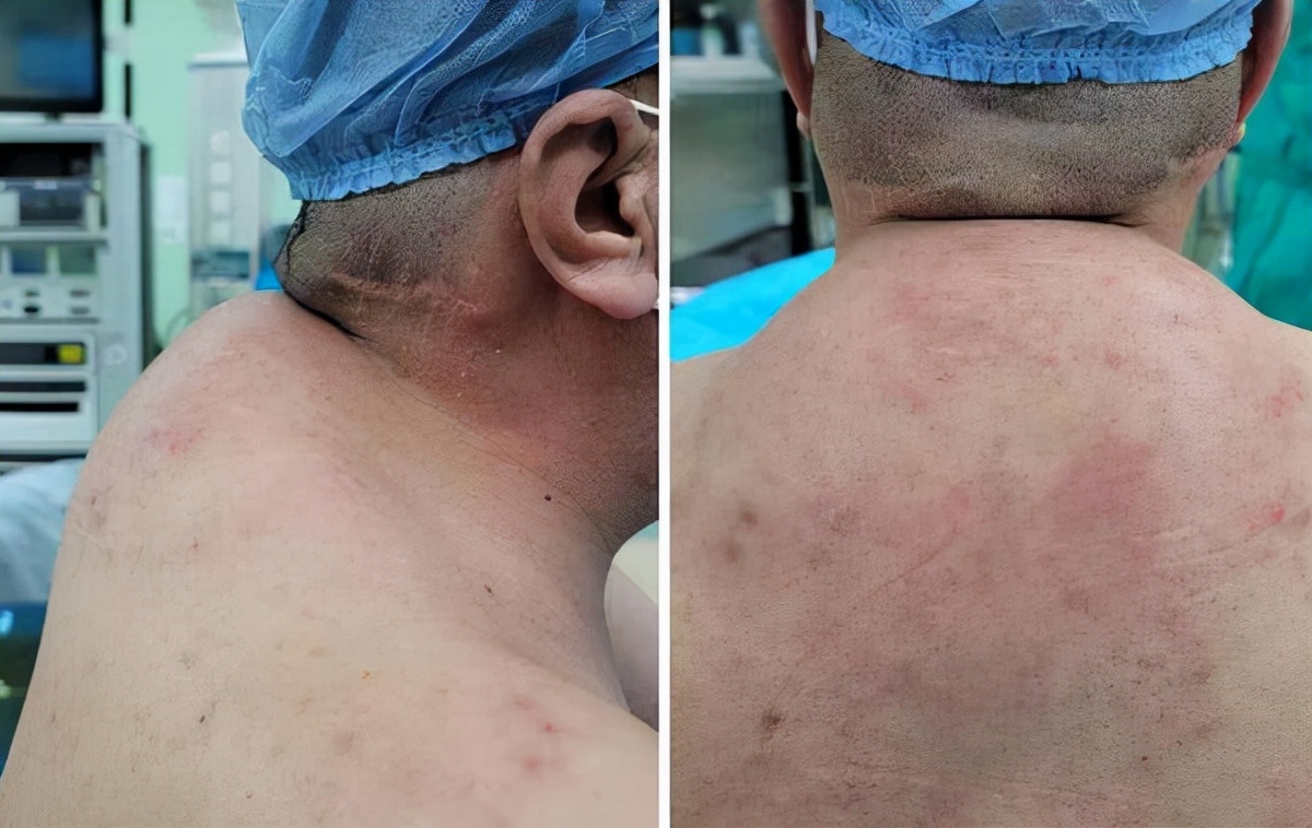 嗜酒如命的男人70岁,48岁大叔一天3斤酒