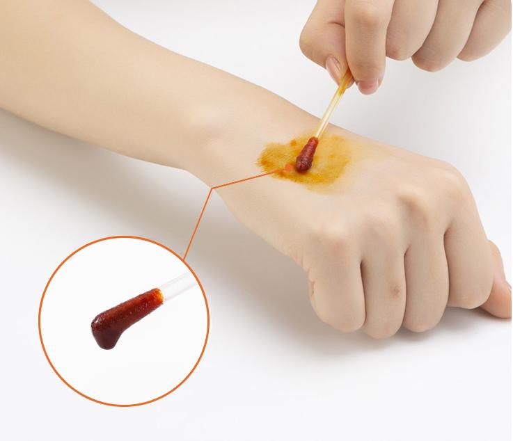 家庭必备品之一碘伏棉签，你用对了吗？