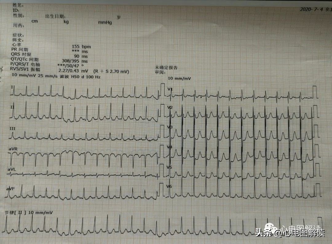 得来不易歌曲视频,得来不易纯音乐