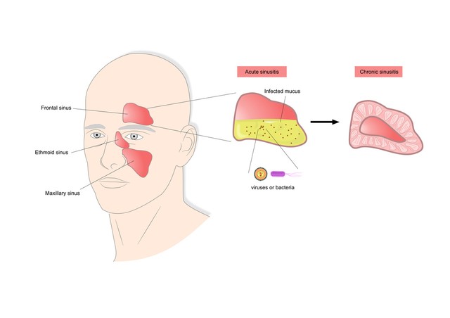 头孢克肟要认清，只对这几类疾病有用，用对是宝，用错有害