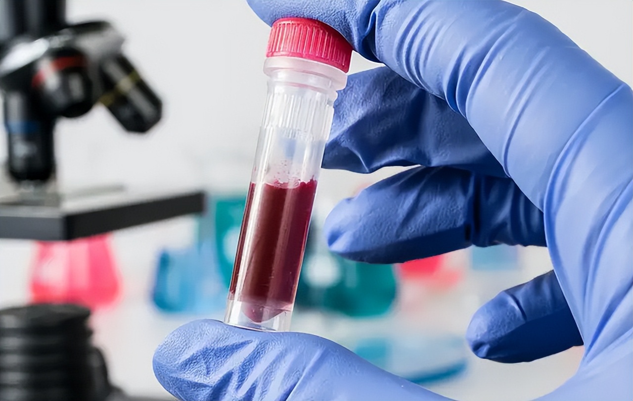 血常规检查各项指标都高什么原因,血常规中哪些指标升高需要再查