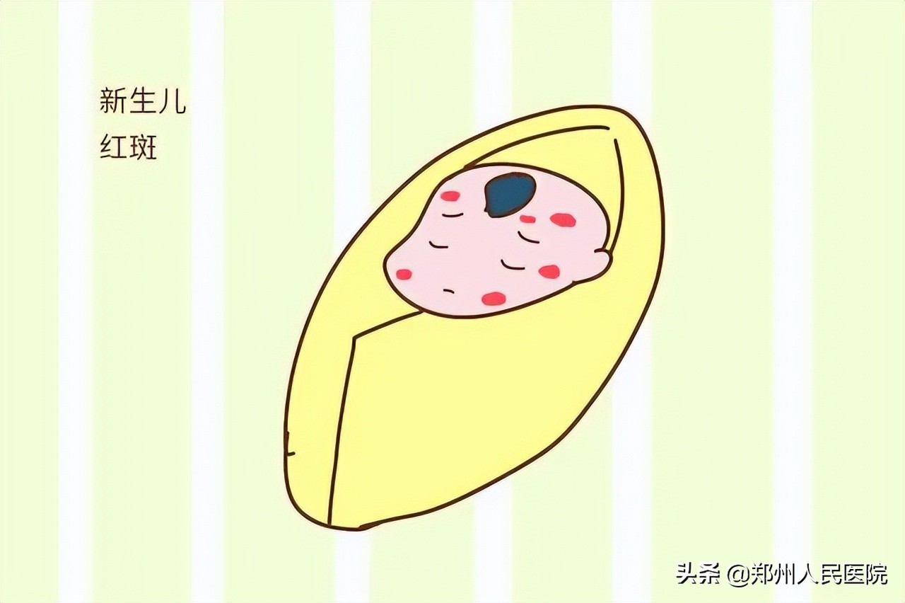 青记、马牙、假月经？别慌！新生儿这些情况都正常