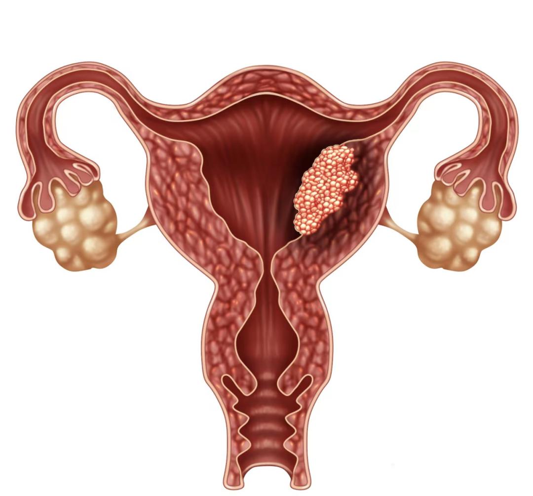 绝经后几年又来大姨妈老年人,大姨妈绝经三四年突然又来了