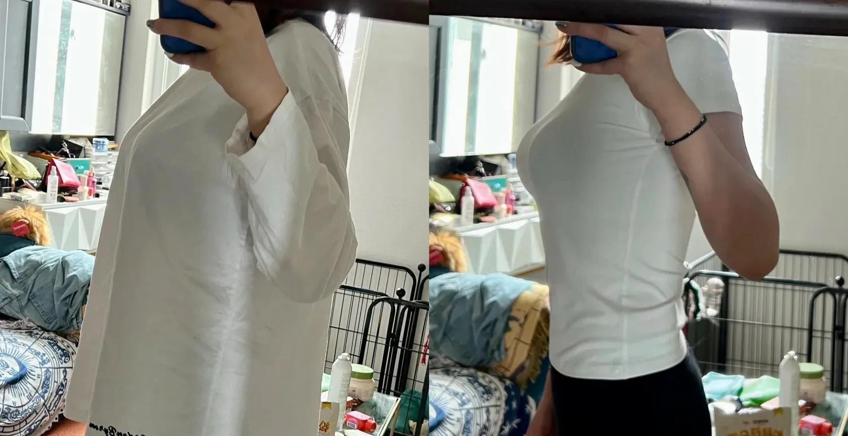 女明星集体回春做了什么医美,女明星集体回春